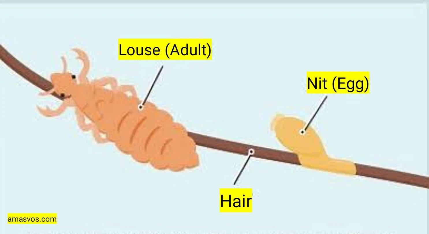 A diagram structure of lice