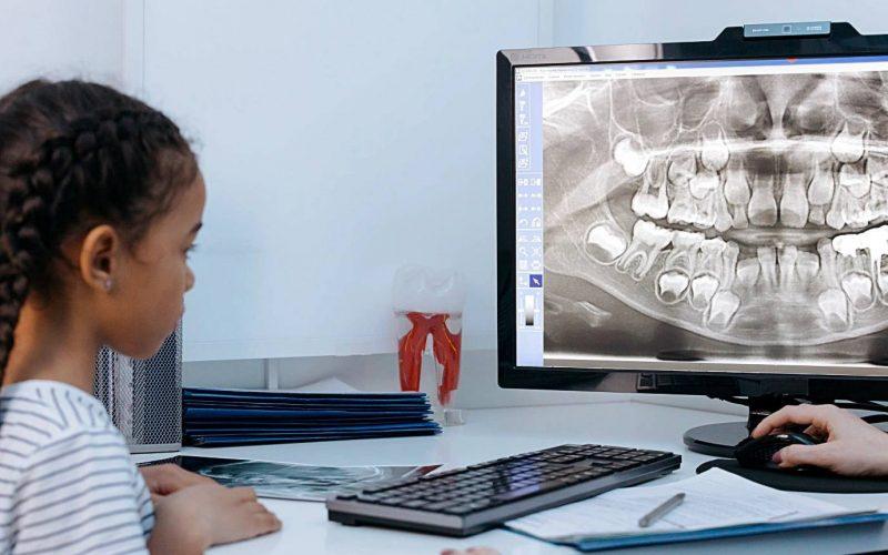 Baby Teeth Xray: Complete Guide