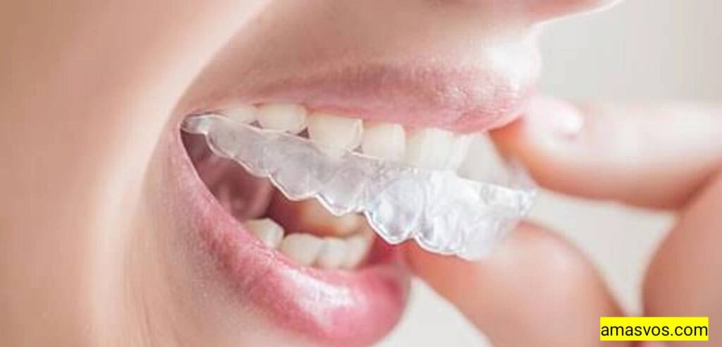 A White women removing on her Invisalign