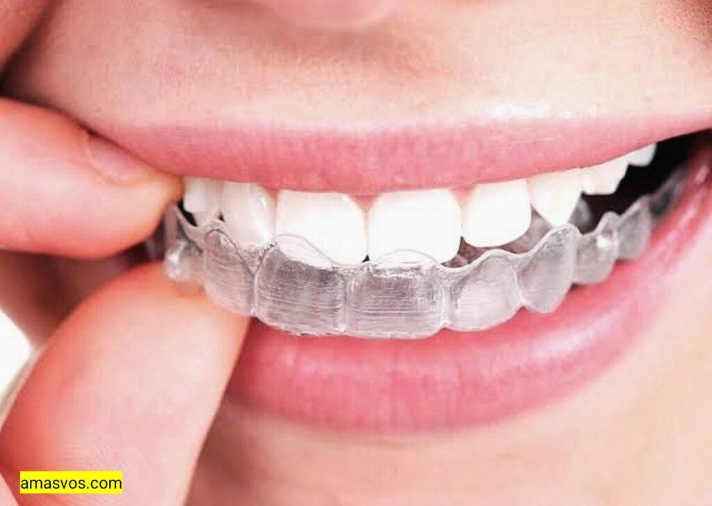 A White women putting on her Invisalign