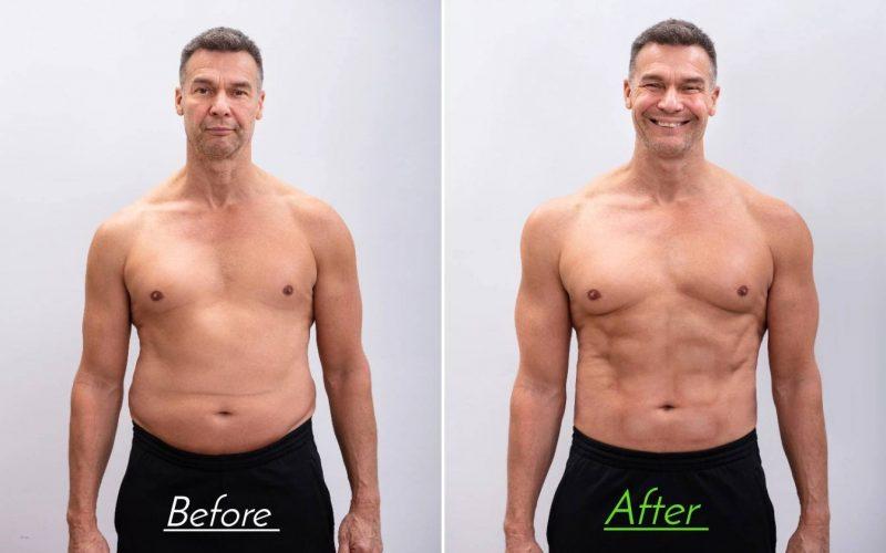Tummy Tuck Before And After Male: (2022 Photos)